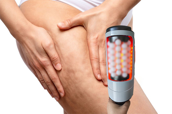 cellulite treatment machine endospheres machine