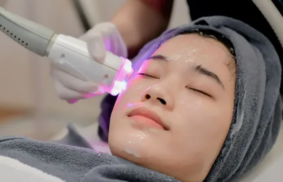 Laser Treatments