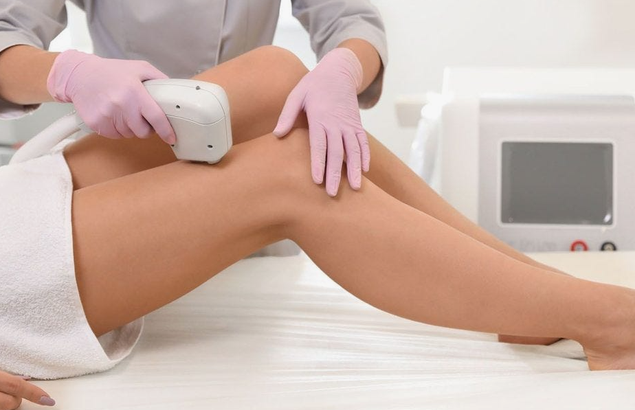 laser hair removal machine